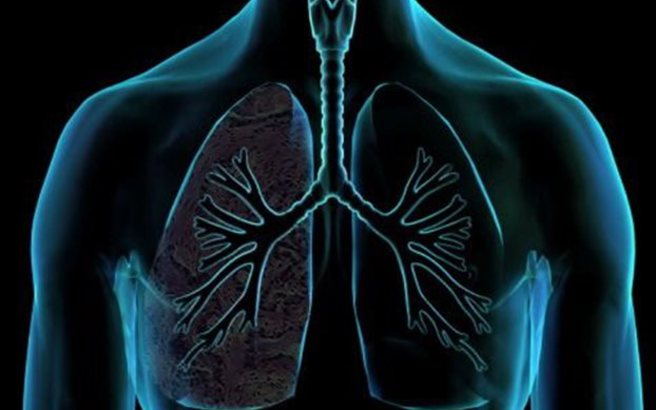 pneumonas.medium