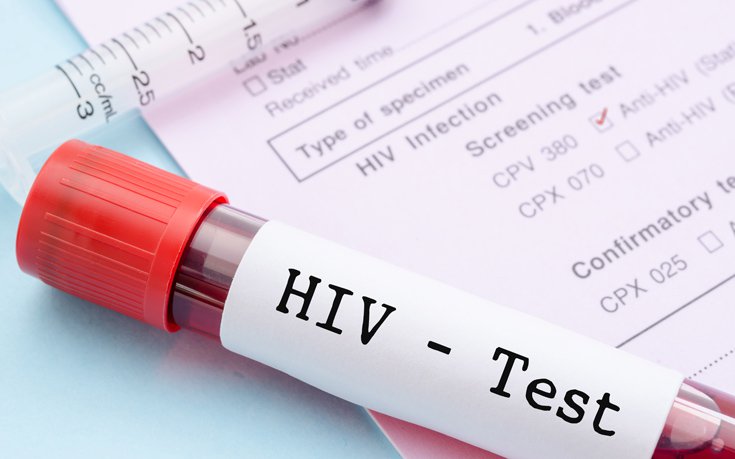 Λιγότερες νέες διαγνώσεις του ιού HIV τα τελευταία χρόνια 4 shutterstock304165361