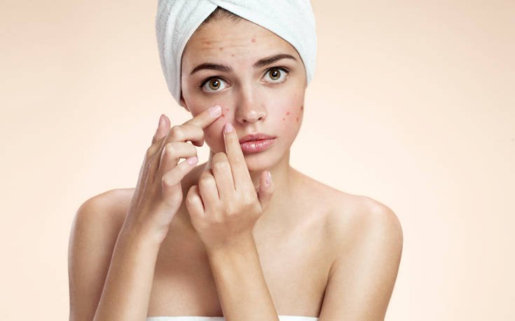 Η ακμή προκαλεί κατάθλιψη 4 shutterstock265872269