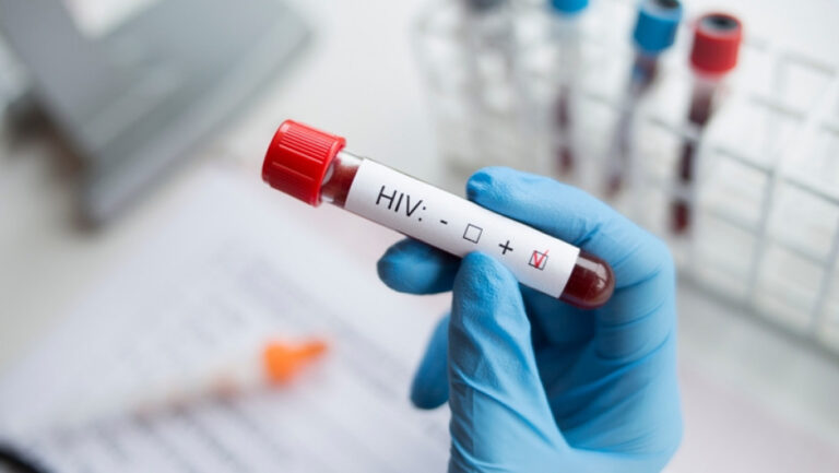 Γυναίκα στις ΗΠΑ θεραπεύτηκε από τον HIV μετά από μεταμόσχευση μυελού των οστών