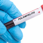 poliomyelitis shutterstock