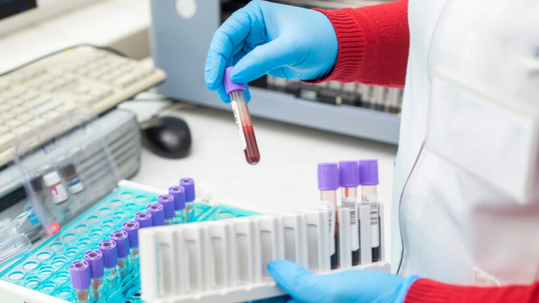 Candida auris: Ενας μύκητας η επόμενη μεγάλη απειλή για τη δημόσια υγεία