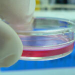 cancer diagnosis