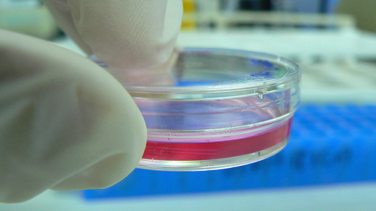 cancer diagnosis