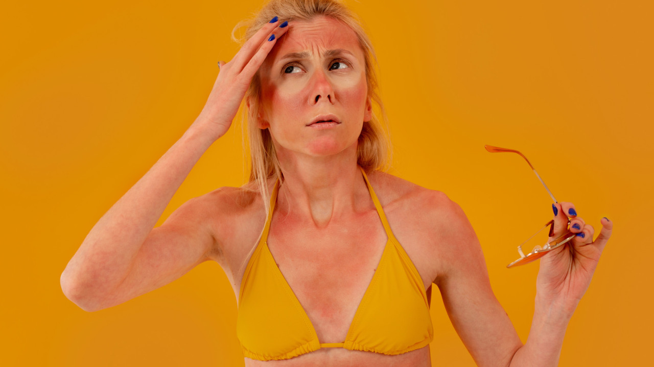 medium shot sunburned woman posing studio