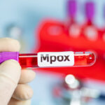 shutterstock mpox