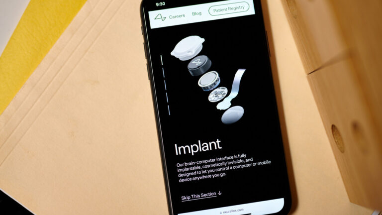 Μασκ: Η Neuralink πήρε έγκριση για να ξεκινήσει δοκιμή τσιπ εγκεφάλου στον Καναδά