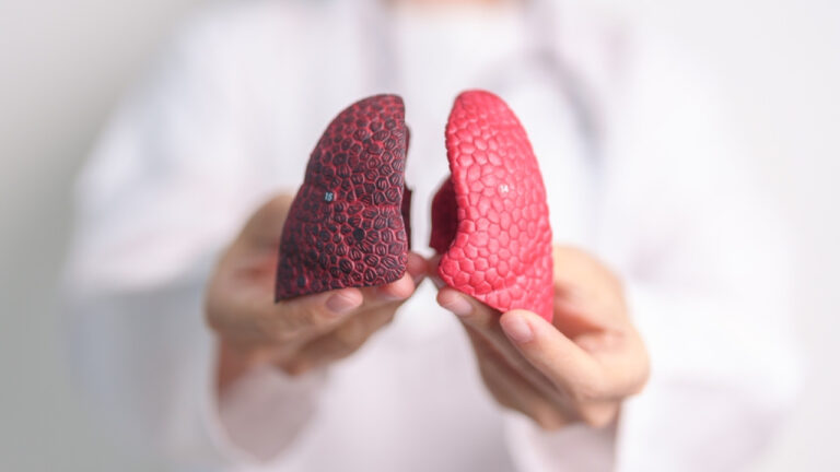 Mελέτη για θεραπευτικό εμβόλιο καρκίνου πνεύμονα στην Ελλάδα – Ποιοι ασθενείς μπορούν να ενταχθούν