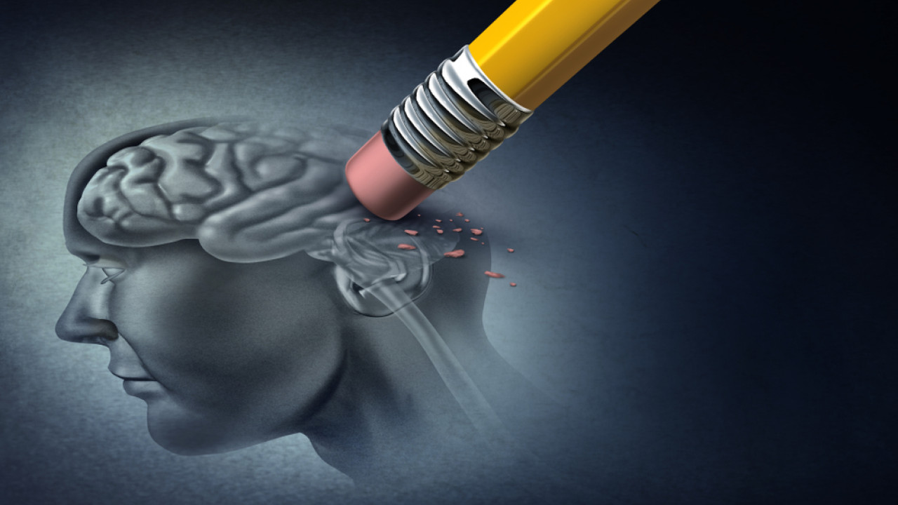 shutterstock alzheimer